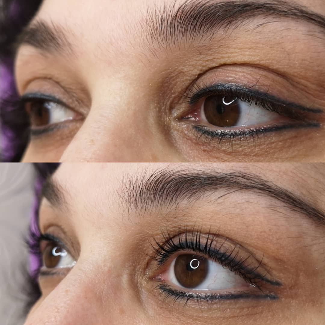 Wimpernlifting